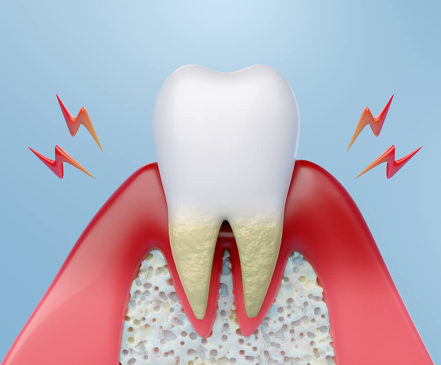 periodontal-disease-treatment-austin-tx